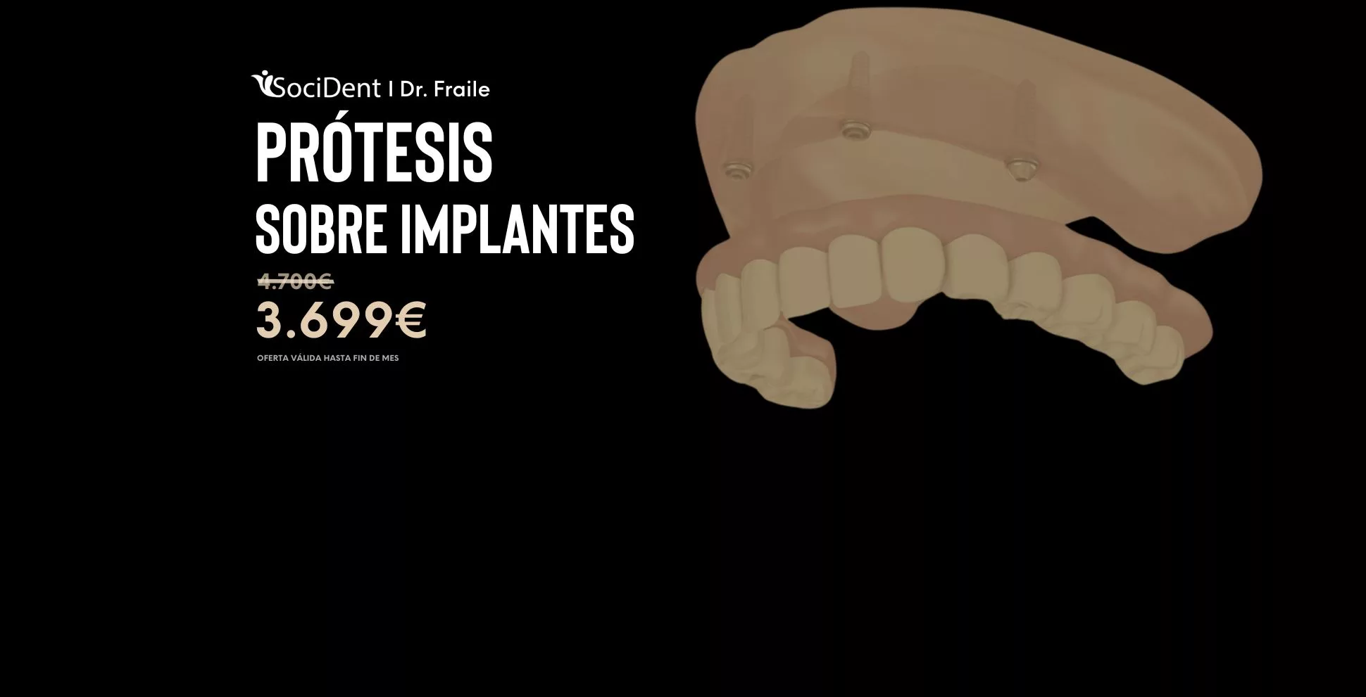 oferta protesis sobre implantes y sobredentadura en mostoles madrid y navalcarnero clinicas socident dr fraile