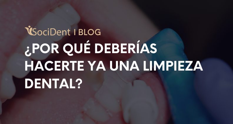 ¿Por qué deberías hacerte una limpieza dental ya?