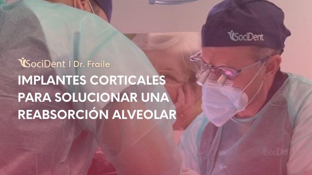 blog-implante-cortical-reabsorcion-alveolar