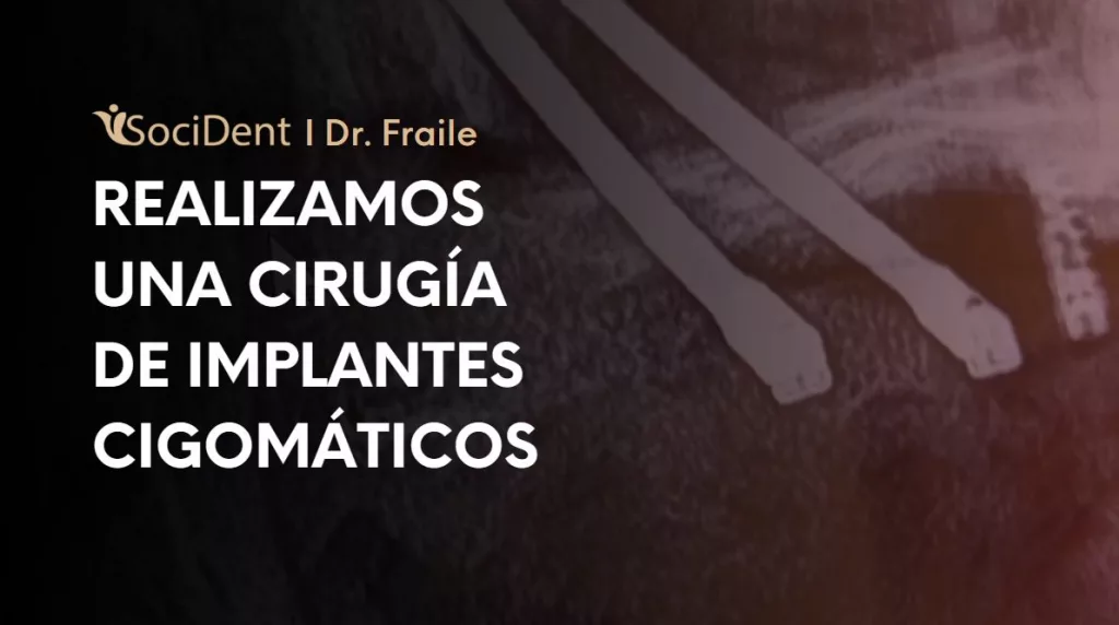 el doctor fraile realiza cirugía de implantes cigomáticos en sus clínicas dentales de madrid, mostoles y navalcarnero