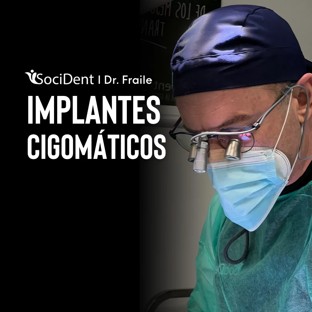 implantes cigomaticos doctor fraile en madrid, mostoles y navalcarnero