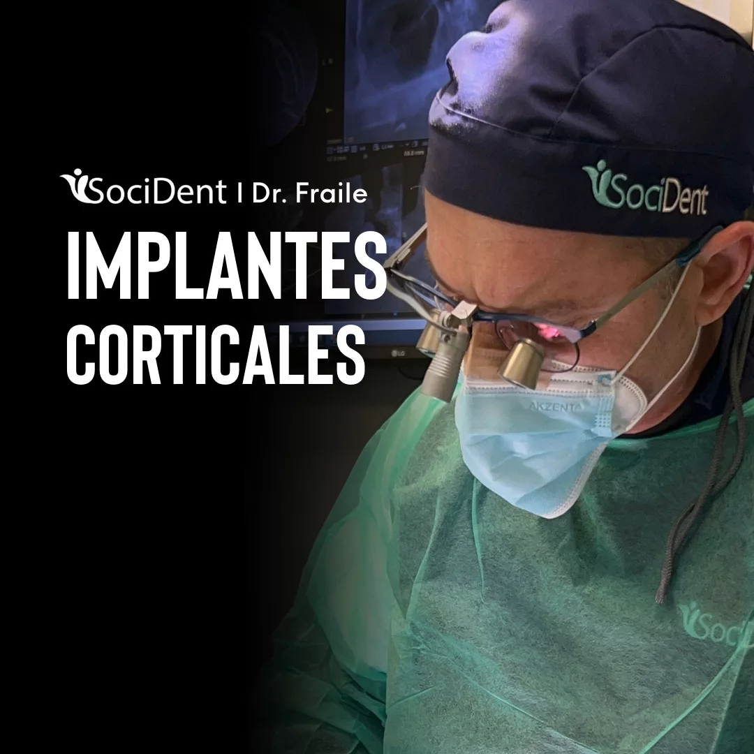 implantes cigomaticos doctor fraile en madrid, mostoles y navalcarnero