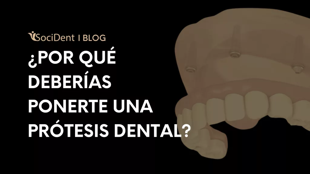 por que ponerse prótesis dental - clínicas dentales Socident en madrid mostoles y navalcarnero