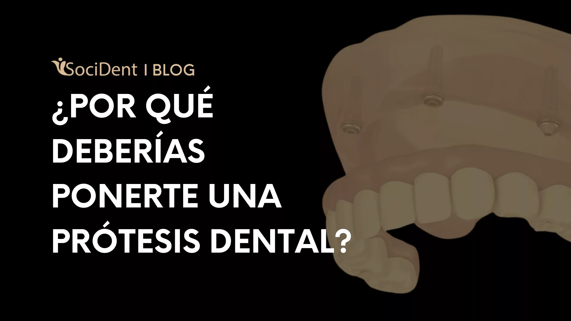 por que ponerse prótesis dental - clínicas dentales Socident en madrid mostoles y navalcarnero